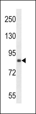 ANTI-MOUSE DDR2 (C-TERM) antibody produced in rabbit