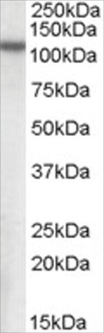 Anti-MP100/NPEPPS antibody produced in goat