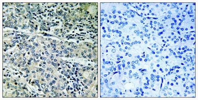Anti-MP68 antibody produced in rabbit