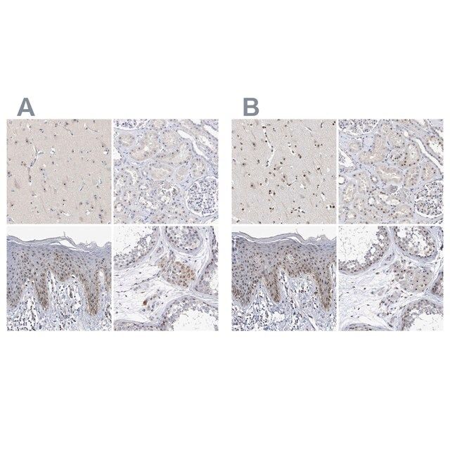 Anti-MPHOSPH10 antibody produced in rabbit
