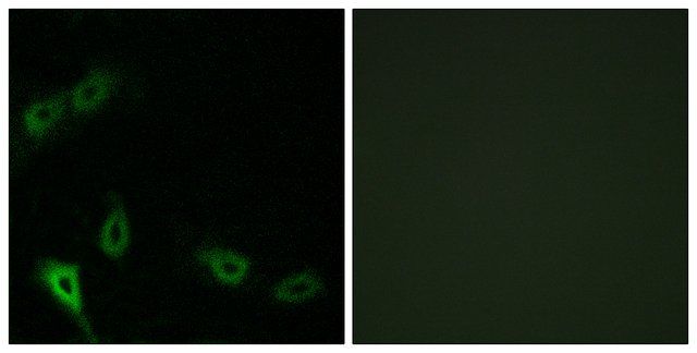 Anti-MARK2 antibody produced in rabbit