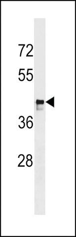 ANTI-MARCH9(C-TERMINAL) antibody produced in rabbit