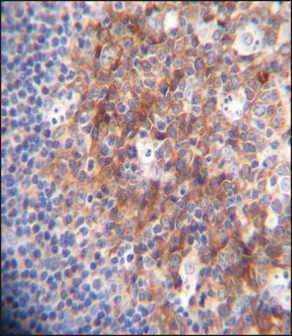 ANTI-MARCO (N-TERM) antibody produced in rabbit