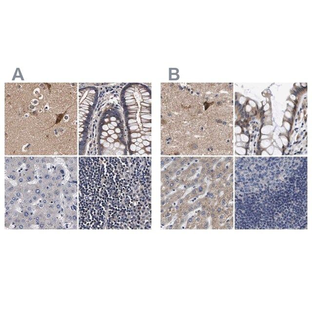 Anti-MARCH7 antibody produced in rabbit