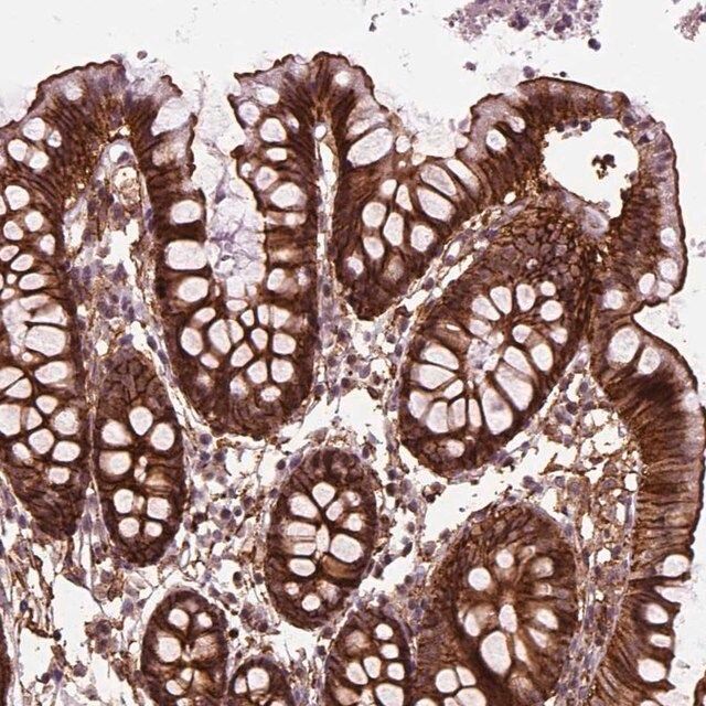 Anti-MARCKS antibody produced in rabbit