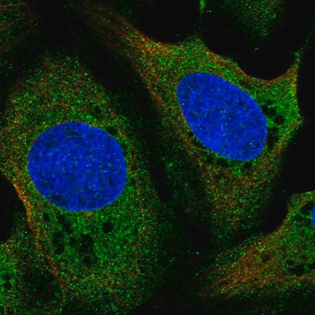 Anti-LDHD antibody produced in rabbit
