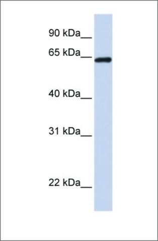 Anti-LCP1 (ab2) antibody produced in rabbit
