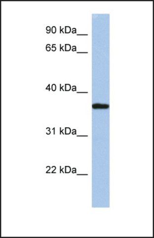 Anti-LDLRAP1, (N-terminal) antibody produced in rabbit