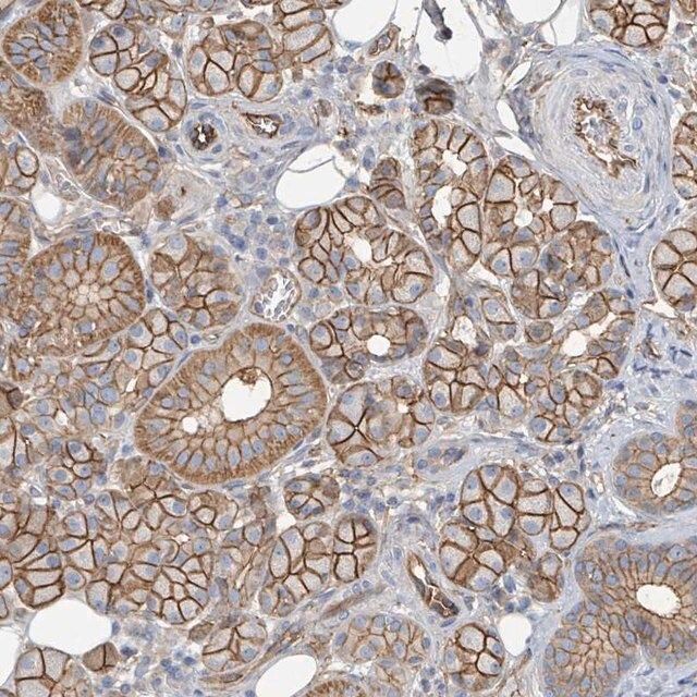 Anti-LDOC1 antibody produced in rabbit