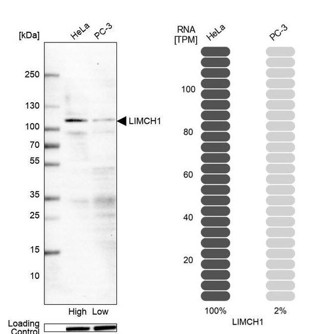 Anti-LIMCH1 antibody produced in rabbit