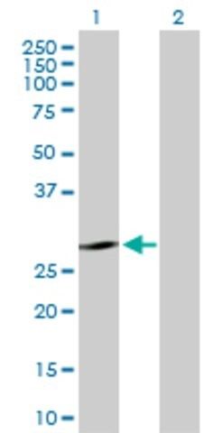 Anti-KLK7 antibody produced in rabbit