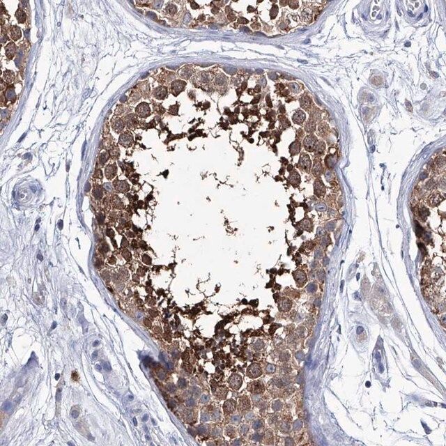 Anti-KLHL17 antibody produced in rabbit