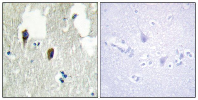 Anti-KLHL3 antibody produced in rabbit