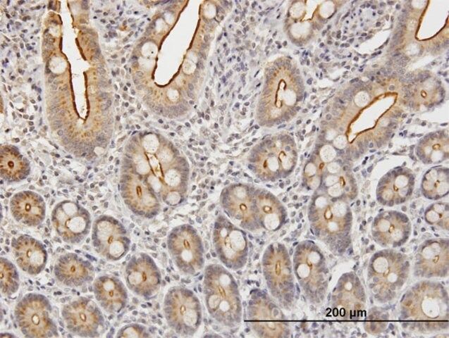 Anti-KLK2 antibody produced in mouse