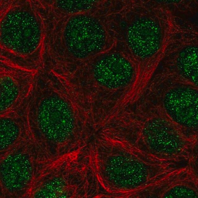 Anti-KLLN antibody produced in rabbit