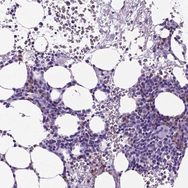 Anti-KLRD1 antibody produced in rabbit
