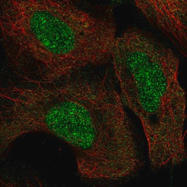 Anti-KMT5A antibody produced in rabbit