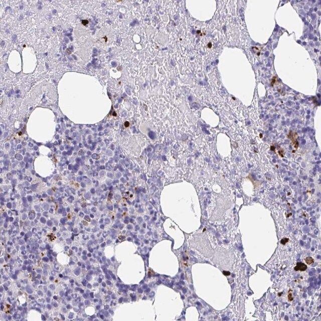 Anti-KMT2E antibody produced in rabbit