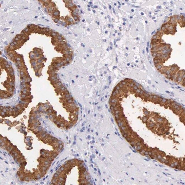 Anti-KLK3 antibody produced in rabbit