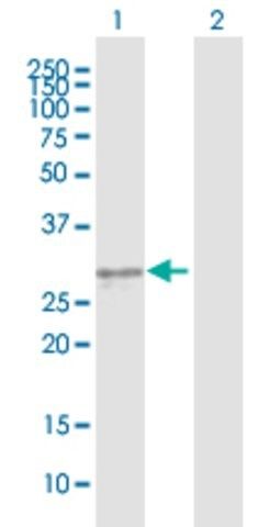 Anti-KLK3 antibody produced in mouse