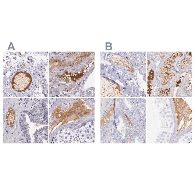 Anti-KNG1 antibody produced in rabbit