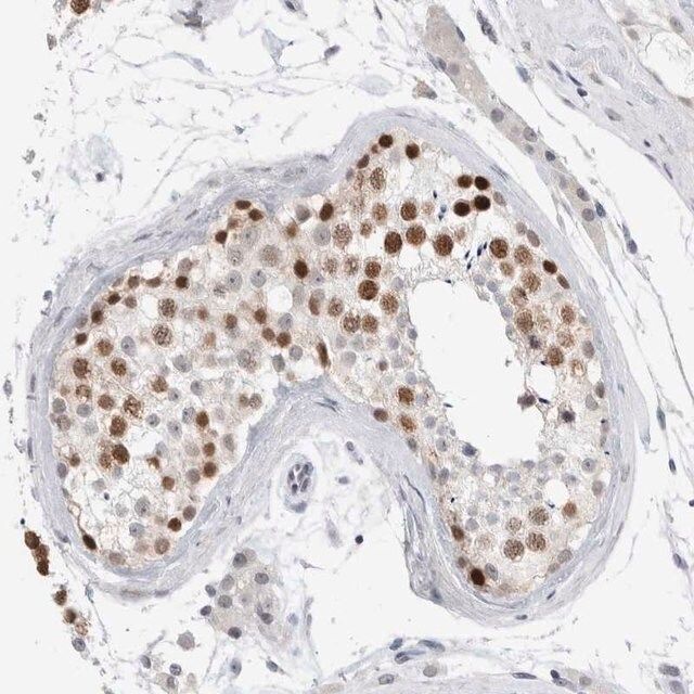 Anti-KNL1 antibody produced in rabbit
