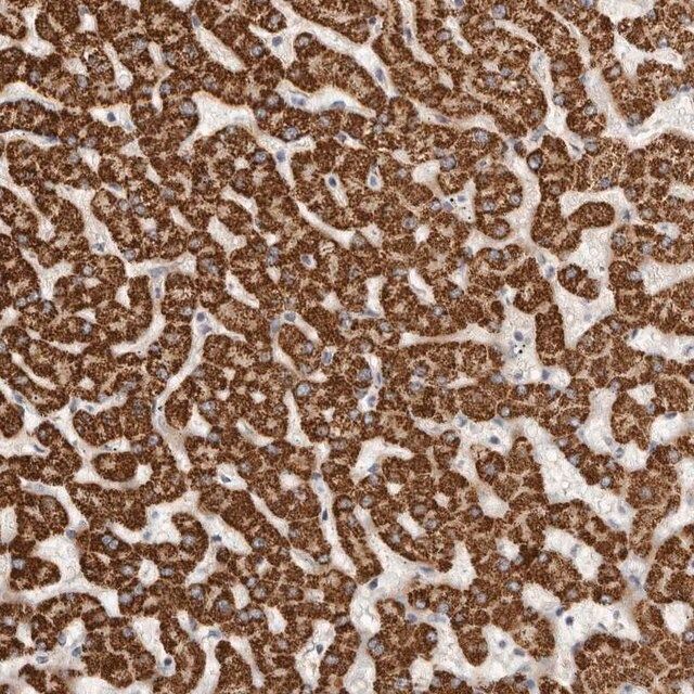 Anti-LCORL antibody produced in rabbit