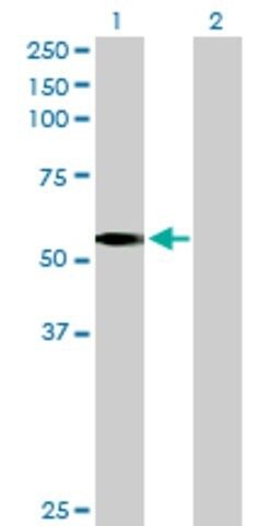 Anti-LDHD antibody produced in mouse