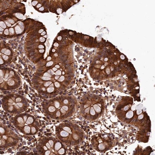 Anti-LCMT2 antibody produced in rabbit