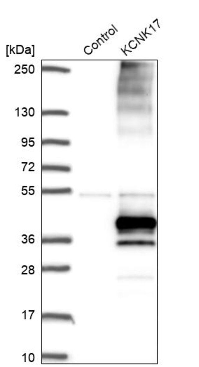 Anti-KCNK17 antibody produced in rabbit