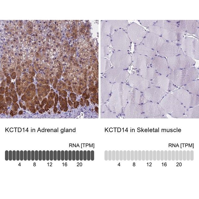 Anti-KCTD14 antibody produced in rabbit