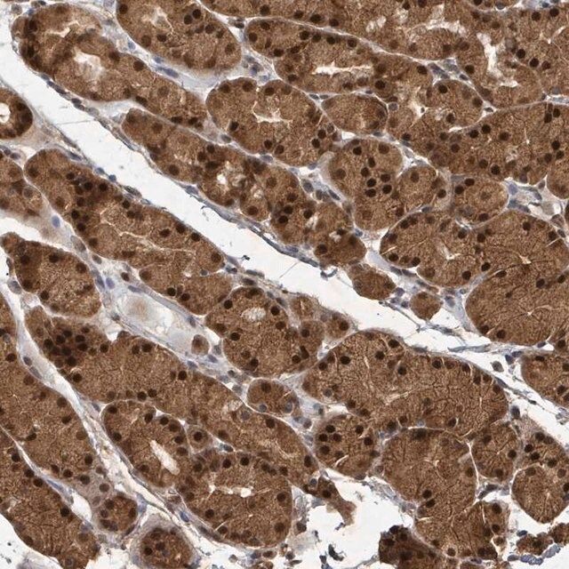 Anti-KDM4E antibody produced in rabbit