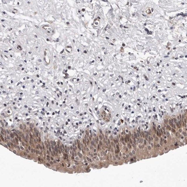 Anti-KIAA1614 antibody produced in rabbit