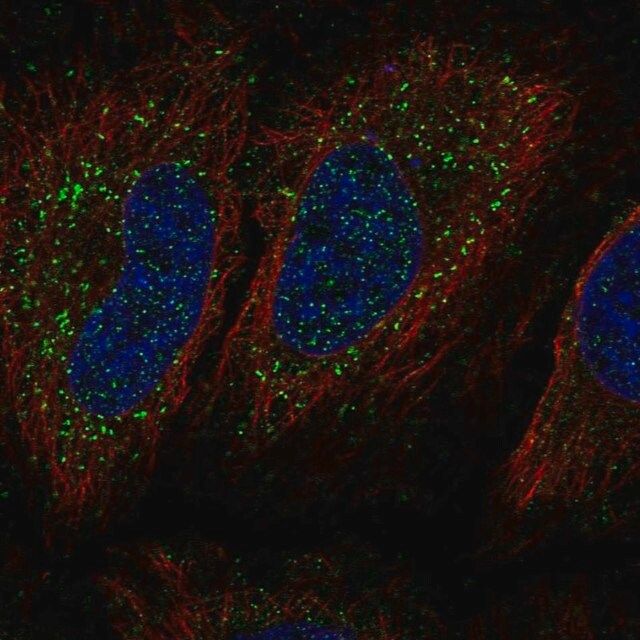 Anti-KIAA0319 antibody produced in rabbit