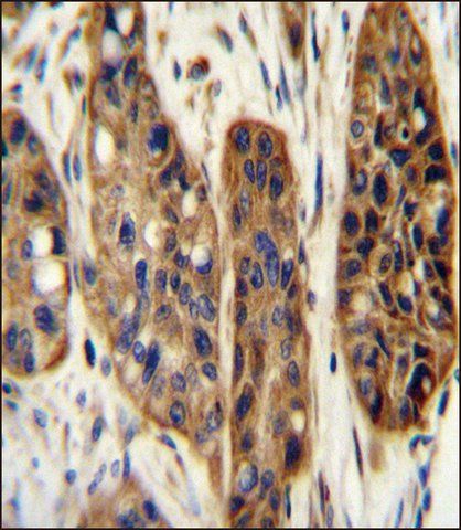 ANTI-KIAA1324L (N-TERM) antibody produced in rabbit