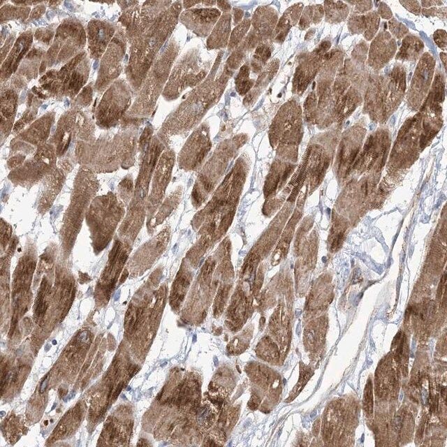 Anti-KLHL18 antibody produced in rabbit