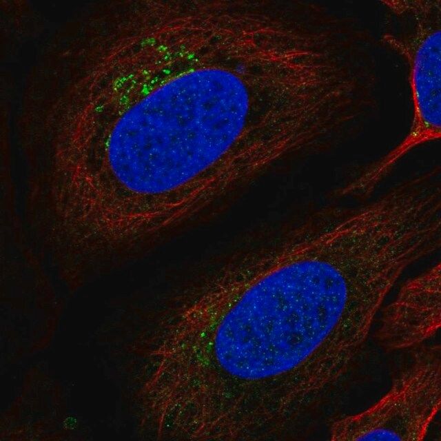 Anti-ITM2B antibody produced in rabbit
