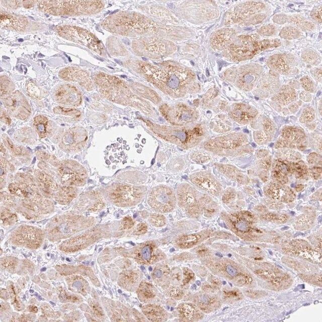 Anti-ITPK1 antibody produced in rabbit