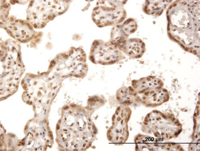 Anti-ITPK1 antibody produced in mouse
