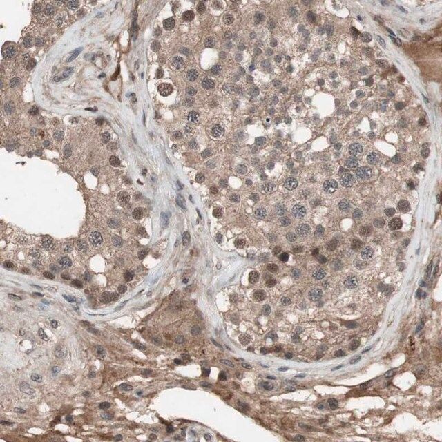 Anti-KANSL1 antibody produced in rabbit