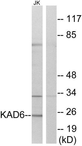 Anti-KAD6, N-Terminal antibody produced in rabbit