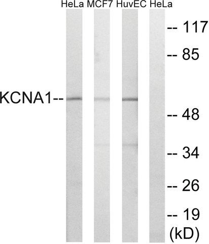 Anti-KCNA1 antibody produced in rabbit