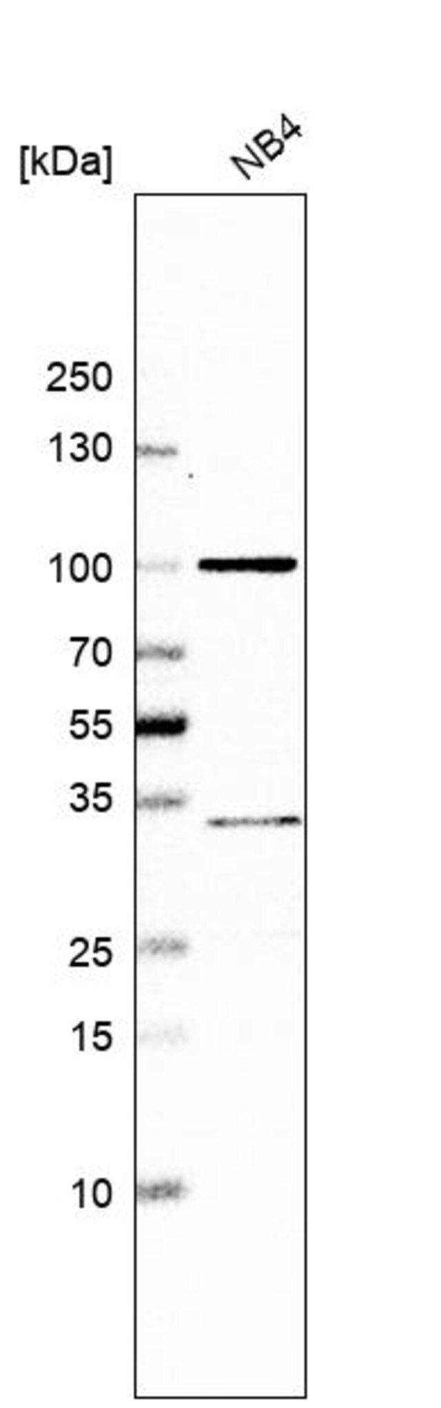 Anti-KCND1 antibody produced in rabbit