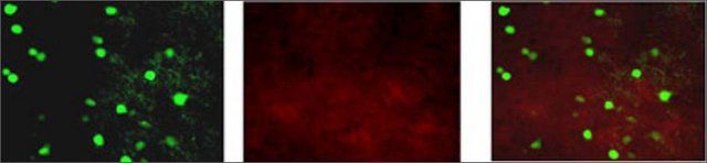 Anti-KCNAB1 antibody produced in rabbit