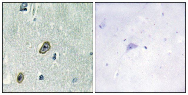 Anti-KCIP1 antibody produced in rabbit