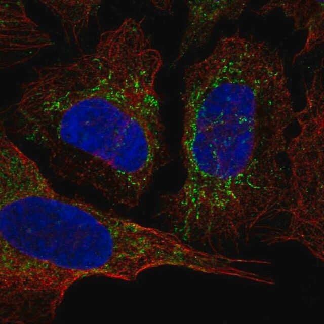 Anti-KCNAB3 antibody produced in rabbit