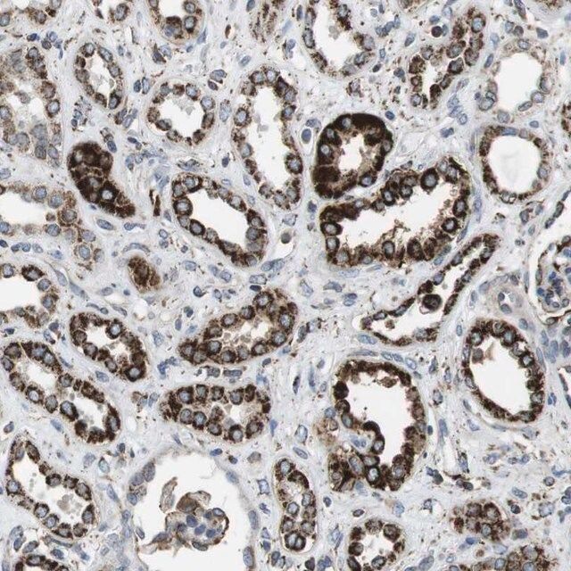 Anti-KCNE3 antibody produced in rabbit