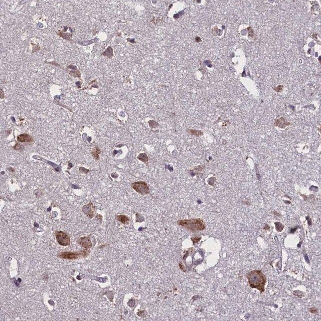 Anti-KCNE5 antibody produced in rabbit