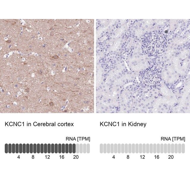 Anti-KCNC1 antibody produced in rabbit