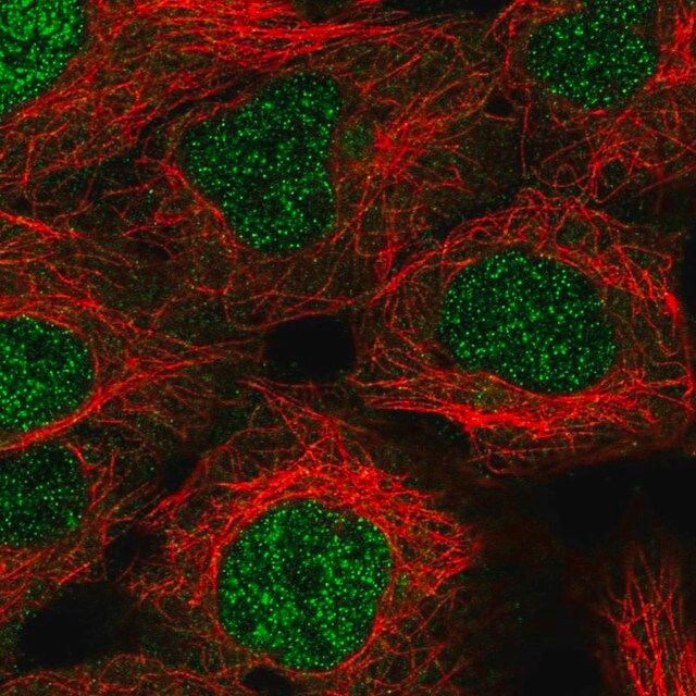Anti-KDELC1 antibody produced in rabbit